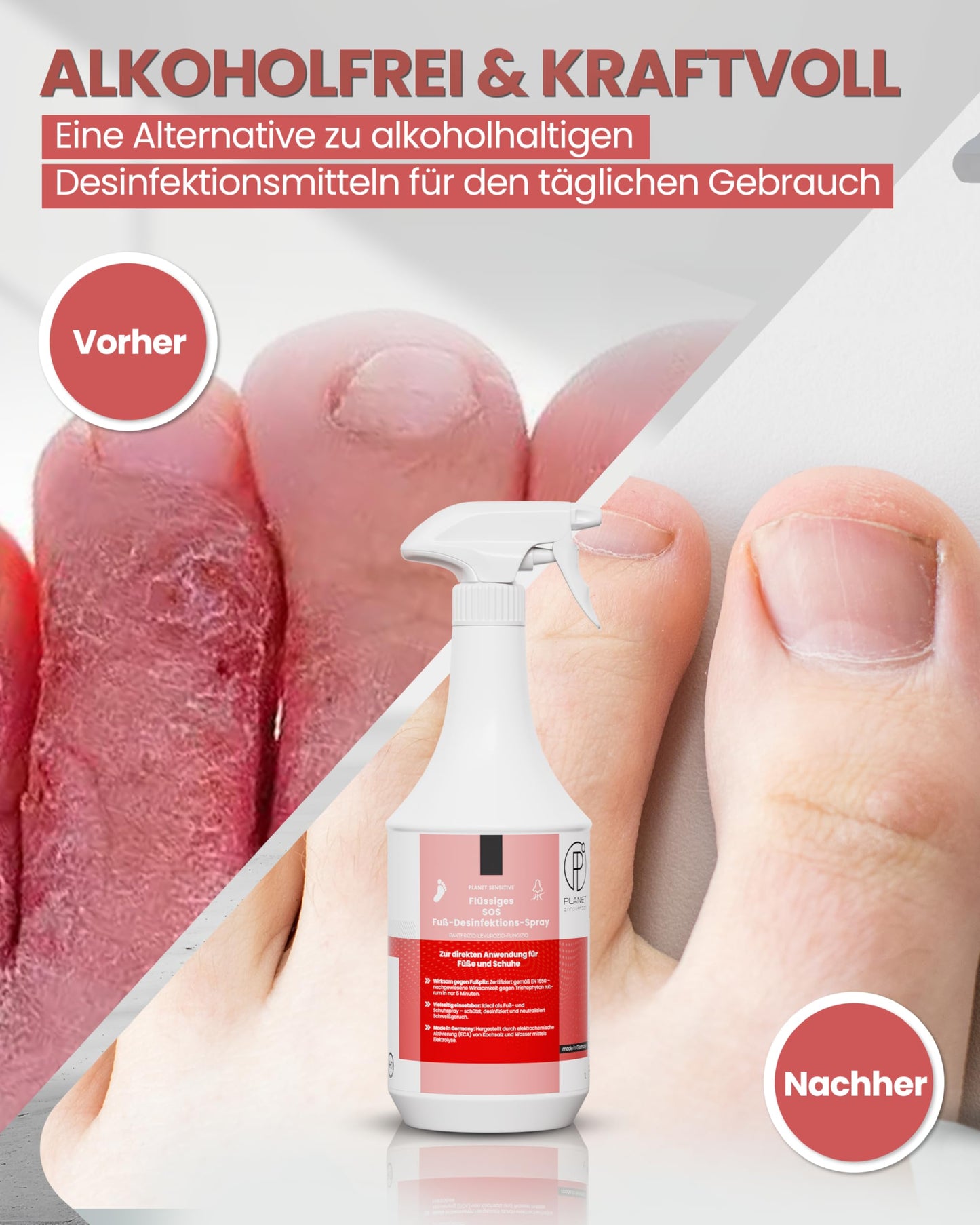 1L SOS Desinfektionsspray für Füße & Schuhe | Planet Sensitive® wirksam gegen Fußpilz, Bakterien, Viren, Hefepilze & Gerüche